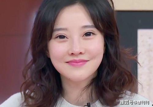 眼睛突出的明星,揭秘那些眼睛突出的明星风采