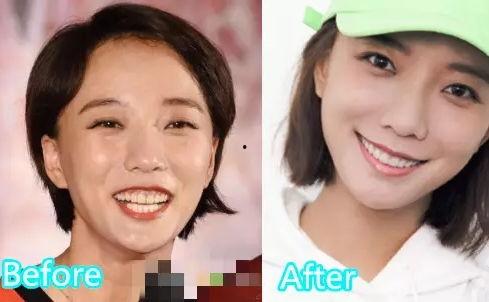 明星是如何美白牙齿,明星美白牙齿秘籍大揭秘